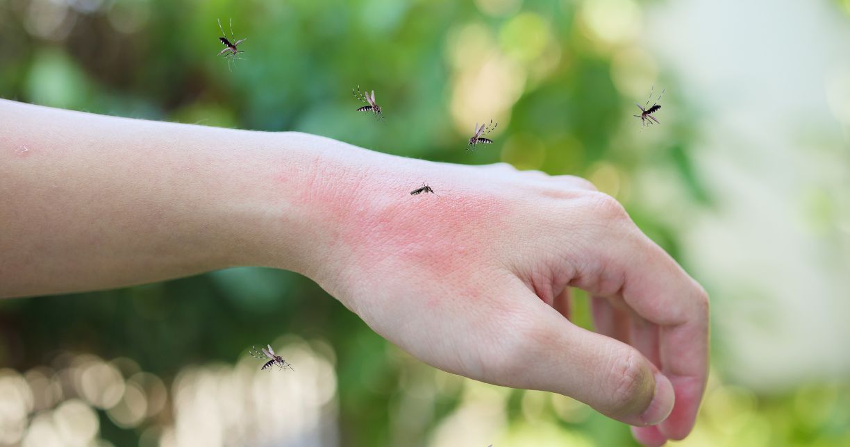 Điều gì xảy ra với cơ thể khi bạn bị muỗi đốt